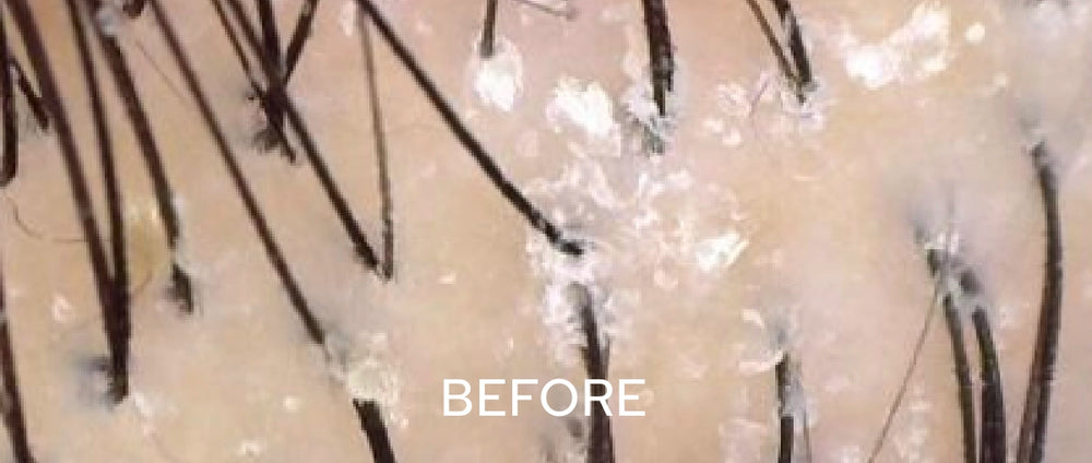 Surface-Only Fixes