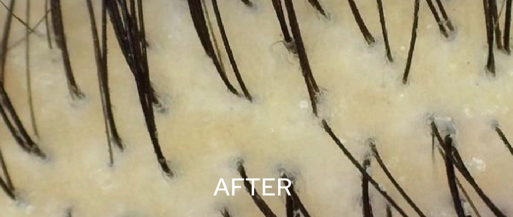Scalp-First & Build-Up Free